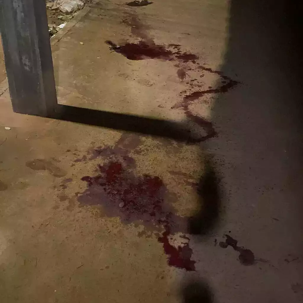 Com 15 tiros, assassino “confere” execução ao voltar e atirar na cabeça de jovem