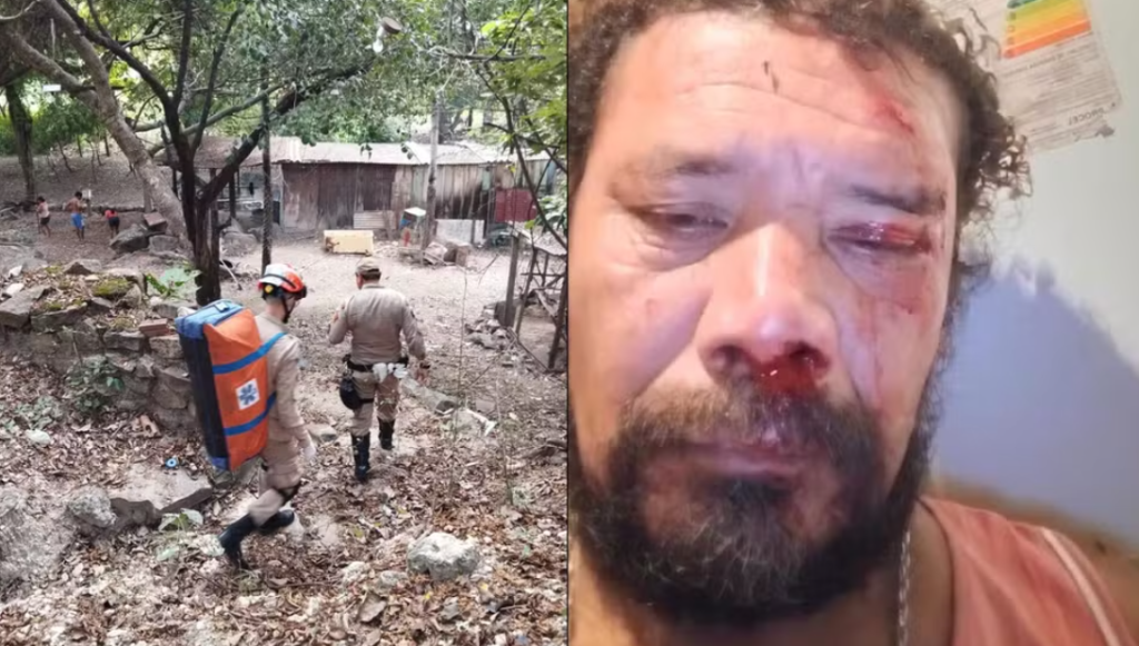 Homem é atacado por onça ao tentar salvar cães no quintal de casa no Pantanal