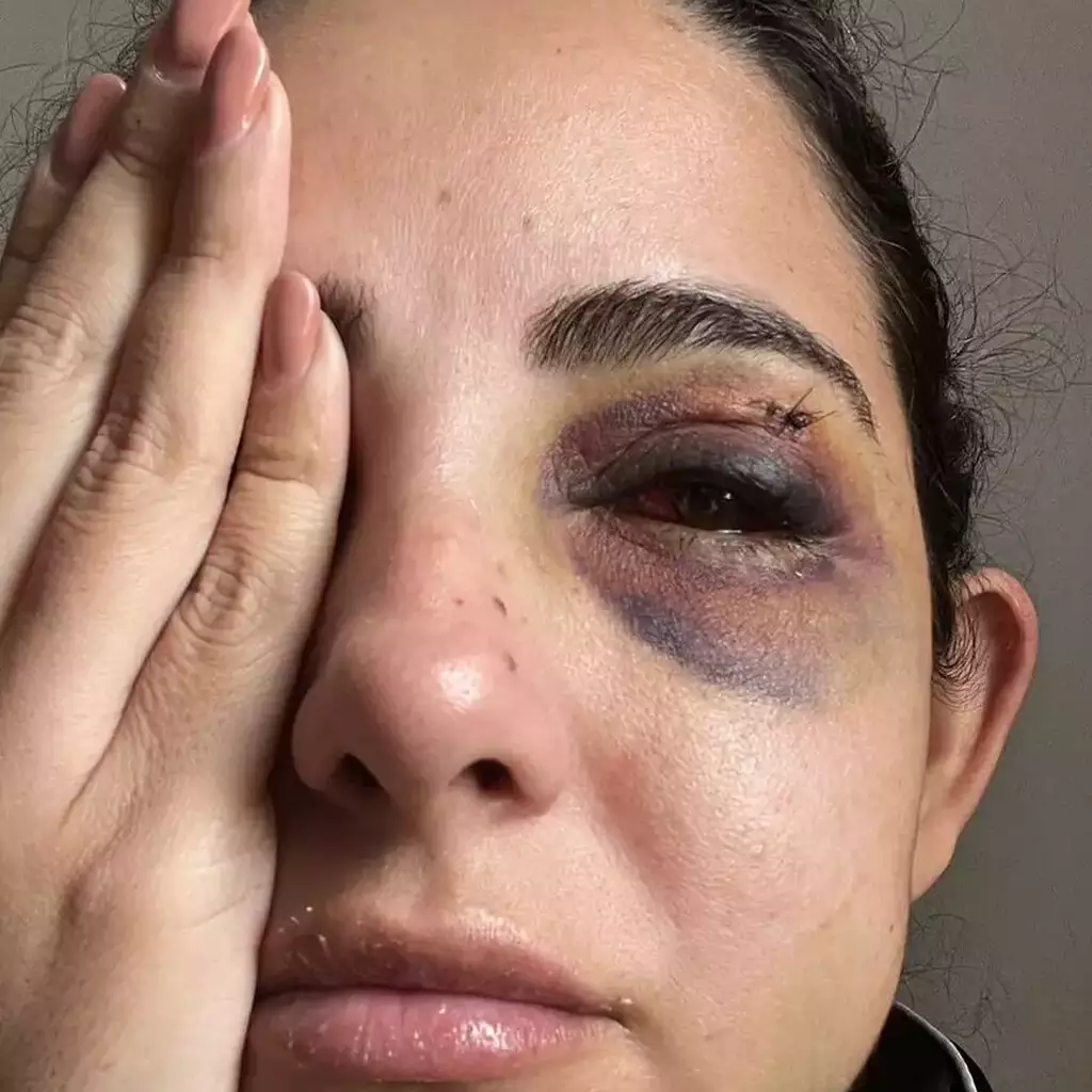 “Quis acabar comigo”: mulher denuncia ex por espancamento, estupro e cárcere